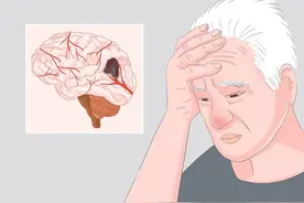 3个部位发麻，很可能是「脑梗」前兆，这几类人需高度警惕！图片