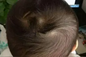 头上两个旋的孩子更聪明？1个旋和2个旋有何区别？科学解释来了图片