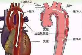 商丘市第一人民医院：20多名专家，9个学科团队，把她从“死神”手中抢回！图片