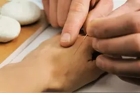 耳鸣去医院做针灸扎了几天 ，右腿居然给整瘸了！走路疼痛难忍至极图片