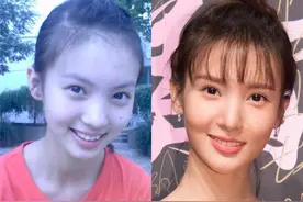 整容有风险，爱美需谨慎！这些整容后遗症你能接受吗？图片