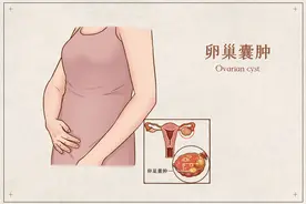一文读懂卵巢囊肿图片