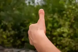当心：手指出现这种肿胀，可能是肝病早期信号！建议及时检查图片