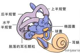 眩晕、恶心、呕吐，可能是“耳石症”，复位是最好的治疗方法！图片