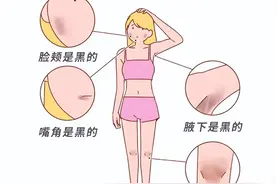 女性身体的这些部位，为啥总是黑黑的？图片