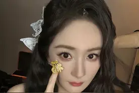 杨幂自曝身体近况，网友：我体检时也有这症状图片