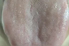 脾虚也分虚实，虚症用归脾丸，实症用二陈丸，千万别弄错了图片
