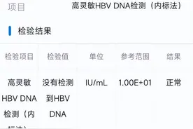 乙肝患者有这4种情况，建议做超高敏乙肝病毒检测！图片