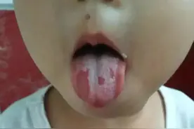 孩子身体怎么样，看看舌头就知道！图片