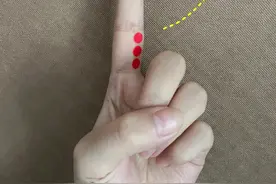 中医针灸穴位 木穴图片