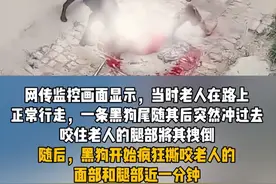 菏泽八旬老人被黑狗撕咬，鼻子被咬掉，眼睛被咬瞎，当地回应图片