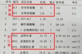 转氨酶升高不可怕，想要快速降酶，记住这3点！图片