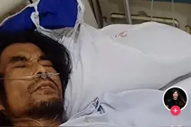 网红“面筋哥”肝癌晚期住进ICU，家属发视频求助称“已经患病好多年”图片