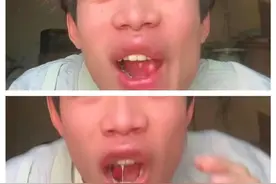 笑不活了！男子回家养蜂，被蜂蜇嘴唇！网友：蜜蜂真配合！图片