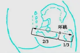 马丹阳天星十二穴 之 环跳穴图片