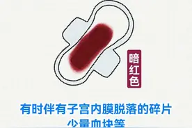 “大姨妈”颜色暗示你的身体健康图片