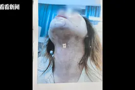 噩梦！沪一女子屡遭施暴！被打断肋骨、划伤胸部...导火索竟是↗图片