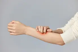冬季皮肤瘙痒？试试补充这6种营养素图片