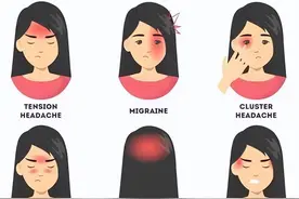 头痛常见病因，总结了20种，太全了！图片