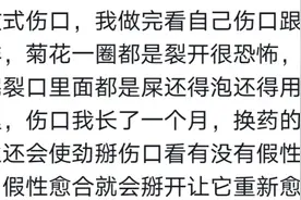 奉劝一句话，没事别随便去噶痔疮。网友：唯一能活活疼死的手术图片