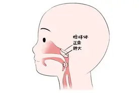 孩子腺样体肥大，两种食物每天换着吃，身体干净脾胃好！图片