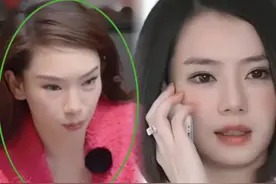 一脸科技感、鼻子像锥子，“过度医美”的女星们，各有各的心酸图片