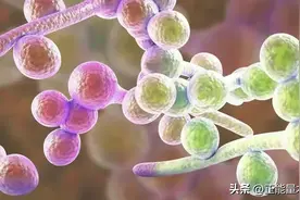龟头炎-男人的烦恼，牢记二点保健康图片