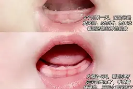 宝宝出牙顺序及护理！4个方法缓解出牙不适图片