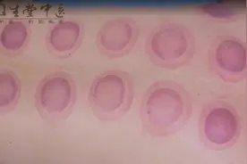 湿疹反复发作怎么办？固生堂中医专家如何治疗？图片