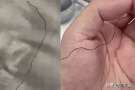 揭秘“发王”之谜：为何你头上有几根头发又粗又硬又卷？图片