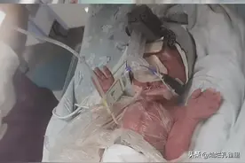 去父留子！网红王小萌诞下双胞胎儿子，疑与同性伴侣各提供一卵子图片