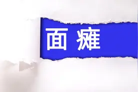 治疗面瘫，除了口服药物和静脉滴注，还有其他办法吗？图片
