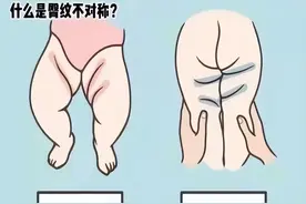 多关心，放“髋”心——关注DDH，让孩子走的更稳图片