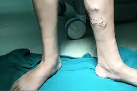 静脉曲张 怎么调？一个方子四味药，活血通经 化瘀清热图片