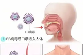 激情一吻连烧7天！4类会通过亲亲传染的病图片