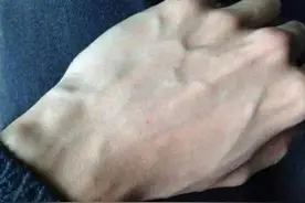 有的人手臂“青筋暴起”，有的人几乎看不到青筋，哪个更健康？图片