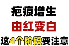 疤痕增生从红到白的3个阶段，如果出现这个现象一定要注意！图片