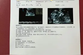 孕12周，来做NT检查啦图片