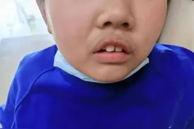 腺样体反复肥大，不是坏事！一个古方，能把痰湿浊气都逼出来图片