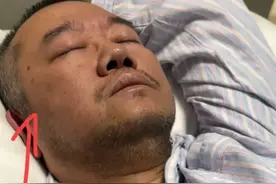 突发！涂磊生病住院，本人晒照很憔悴，满脸胡渣状态看着很差图片