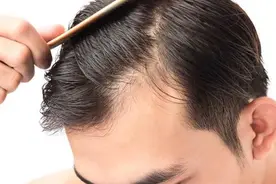 让头发快速生长并保持亮丽！4种食物和1种蔬菜值得推荐图片