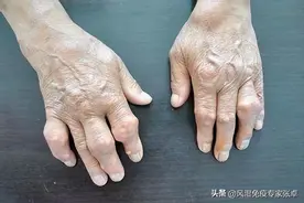 祛湿、补肾、降尿酸治痛风的6大中药，很不一般，仔细看看图片