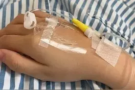 第一次知道什么是囊肿图片