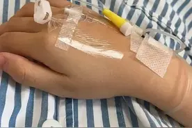 第一次知道什么是囊肿图片