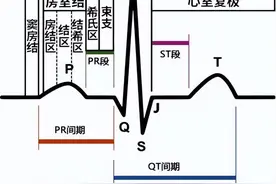 急性心梗心电图，各阶段特点及异常Q波的诊断与鉴别诊断图片