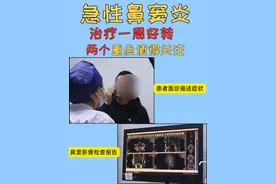 急性鼻窦炎治疗一周好转，两个重点值得关注图片