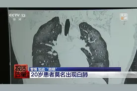 警惕！防晒喷雾可能引发“白肺”，使用不慎还可能变喷火枪图片