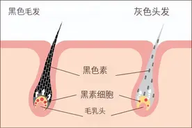 头发白了，还能变黑吗？医生的答案出乎意料图片