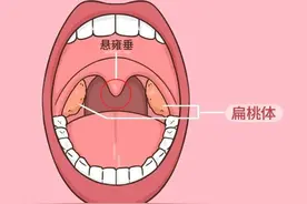 7个月宝宝吃了根头发，结果竟要全麻手术......医生：罕见！从未遇过图片