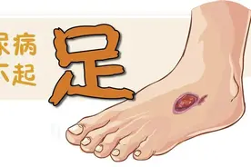 脚比脸更重要？别不当回事！当糖尿病足遇到……图片
